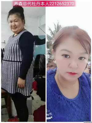 过度减肥的后果