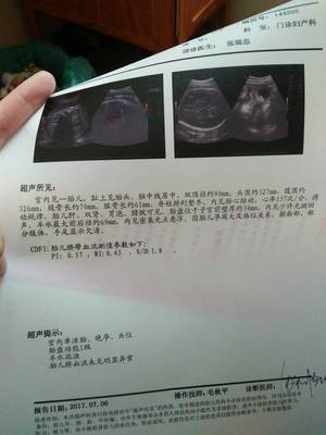 如何算宝宝体重