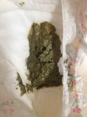 宝宝大便青色