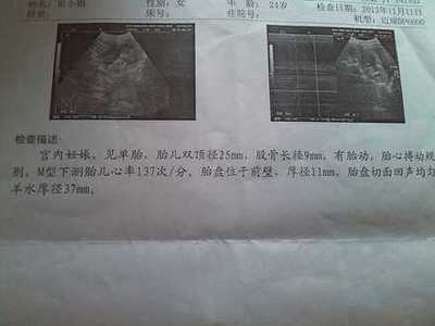 孕妇都做什么检查