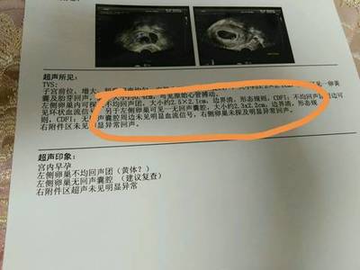 怀孕40天孩子多大