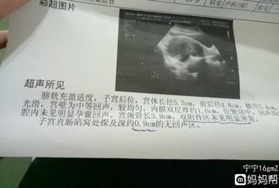怀孕四十天彩超图片