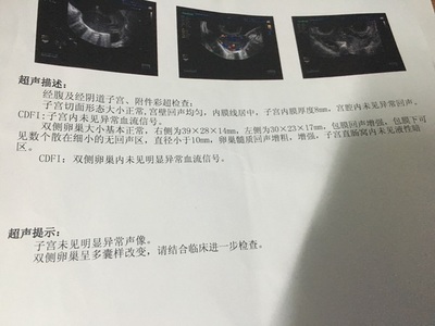多囊怀孕