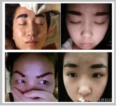 半永久眉毛失败案例