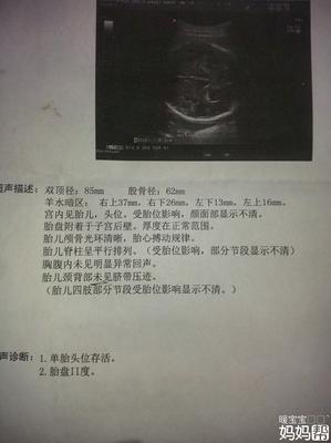 胎儿头位是入盆了吗