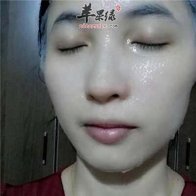 痘印可以自己淡化吗