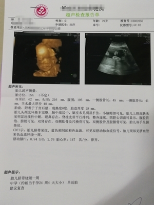 怀孕六个月胎儿有几斤