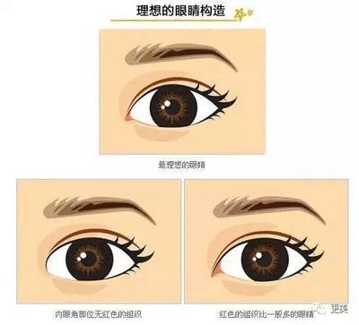 那些眼睛不适合开眼角