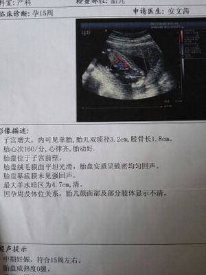 孕15周胎儿