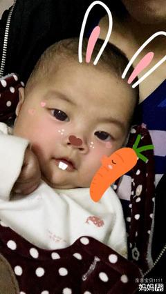 三个月宝宝发烧正常吗