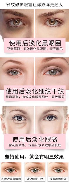 眼霜去黑眼圈有用吗