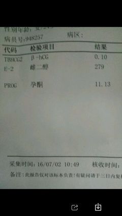 怀孕多久抽血可以检查出来