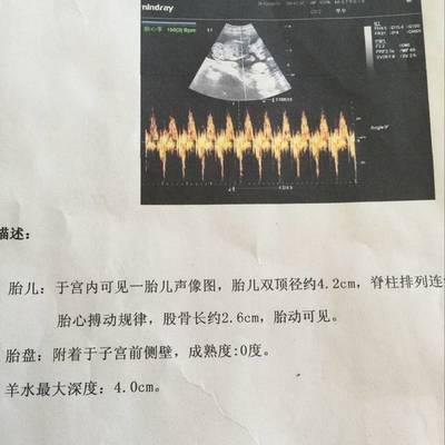 四个月胎儿图彩超图片
