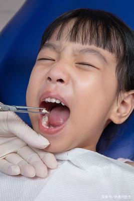 拔牙多久可以恢复