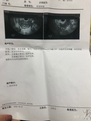 怀孕6周可以药物流产吗,一个月后可以药物流产吗?