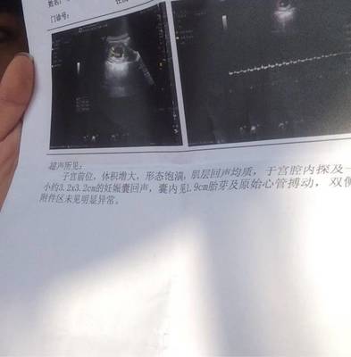 怀孕8周胎芽多大正常