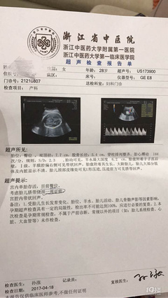 30周胎儿图片