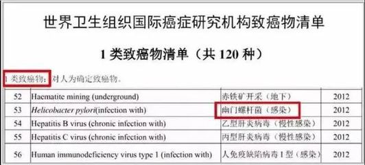 美国查幽门螺杆菌多少钱