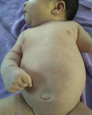 六个月的宝宝肚子胀气怎么办
