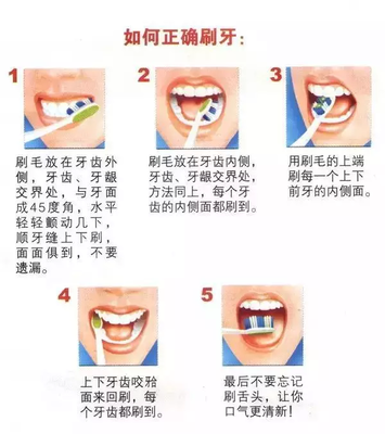 保护口腔小常识