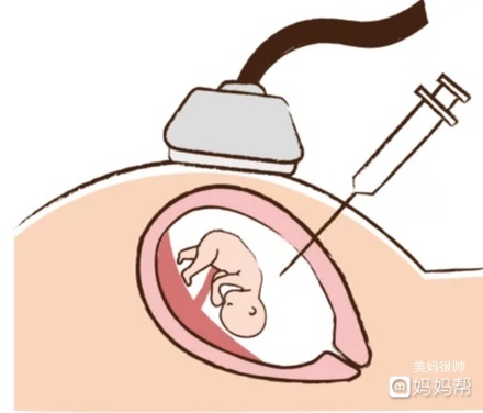 孕几周胎儿才上升腹部