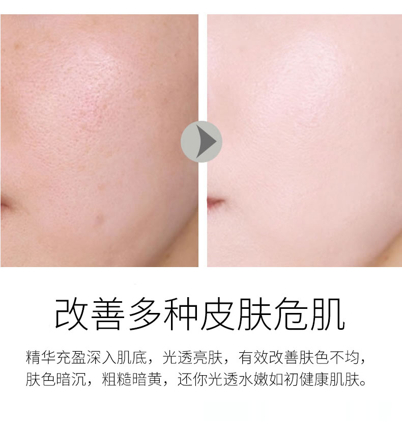 玻尿酸水光原液