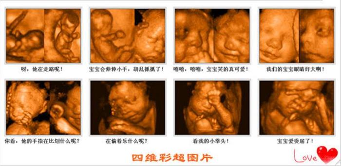 怀孕20周是多少天