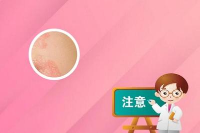 什么药物可以治理痘痘