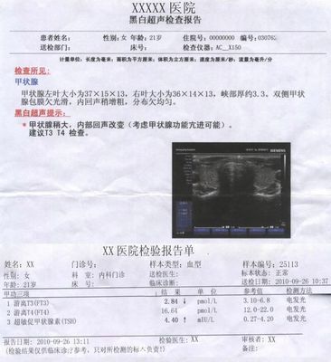 甲亢对胎儿有什么影响