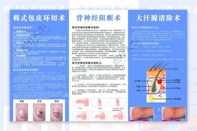 韩式包皮环切