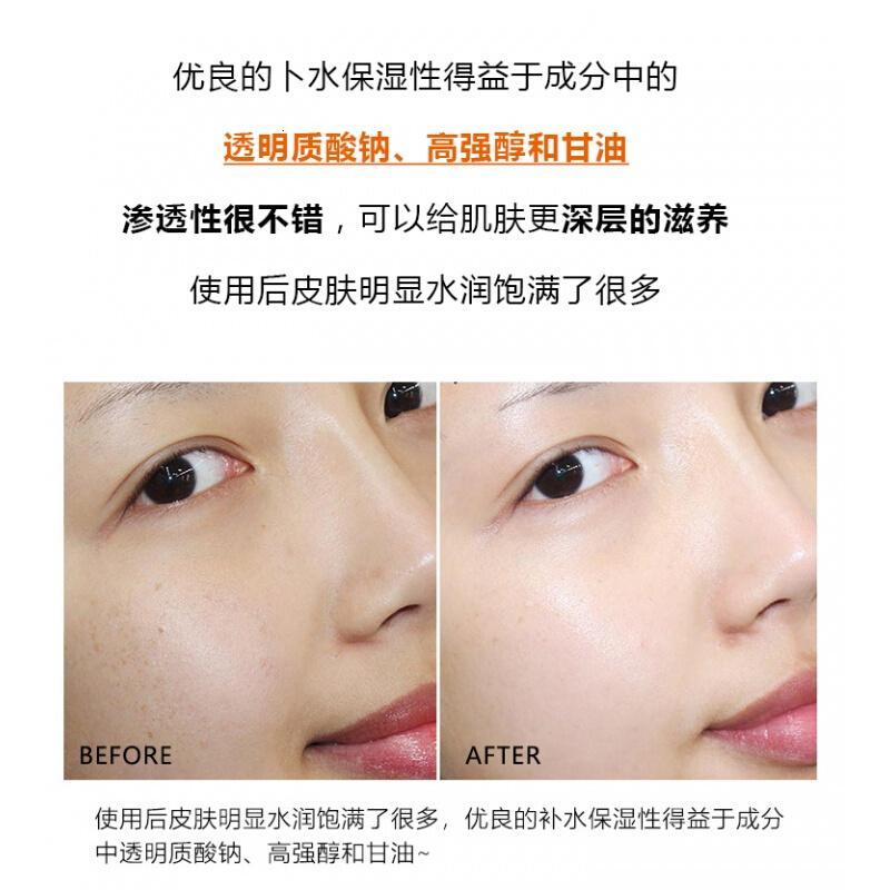 红血丝皮肤用什么面膜