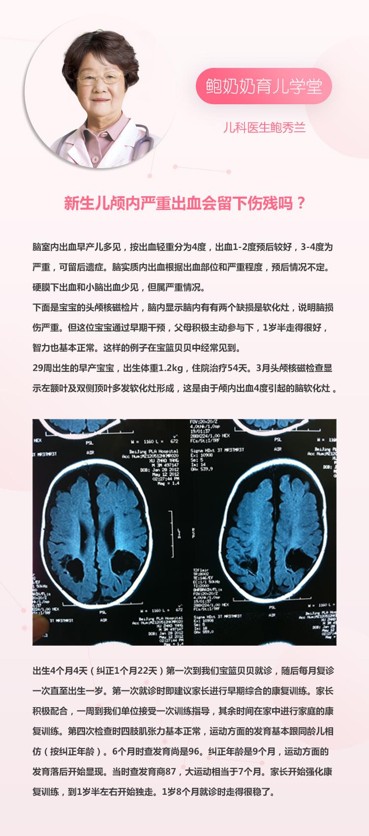 颅内出血属于几级伤残