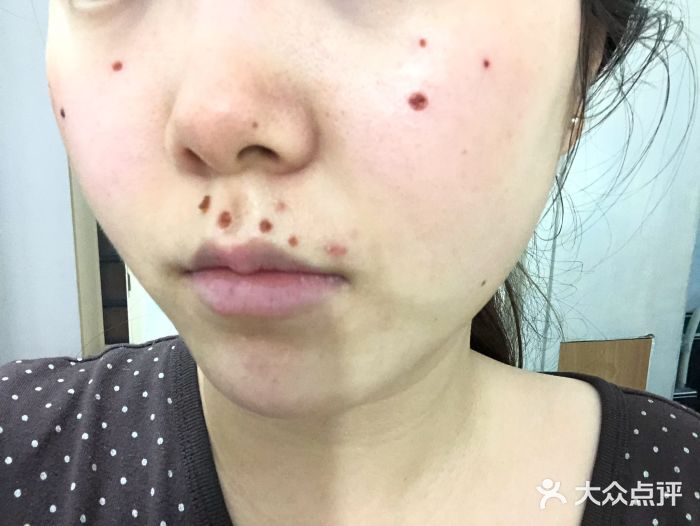 点痣挂什么号