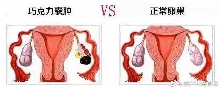 经血呈褐色是怎么回事