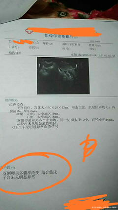 卵巢多囊样改变怎么治疗