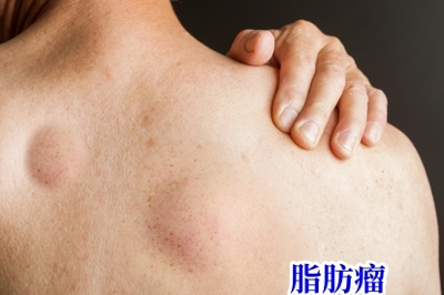 后背脊柱两侧发痘痘
