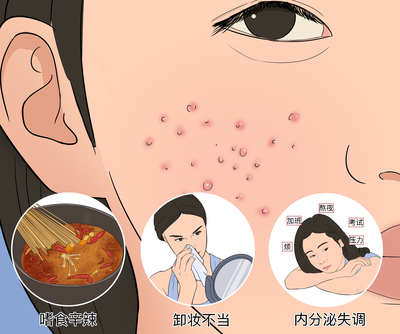 上火张痘痘疼