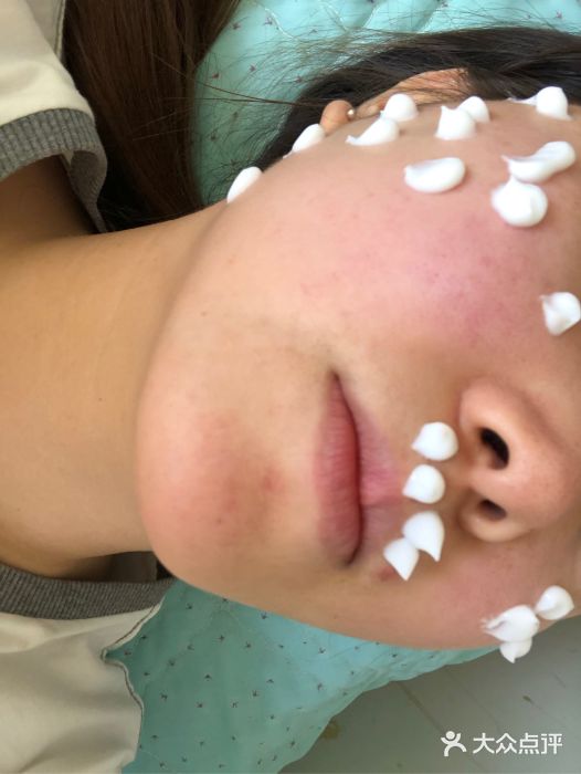 点痣挂什么号