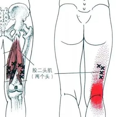 脚面关节疼是怎么回事