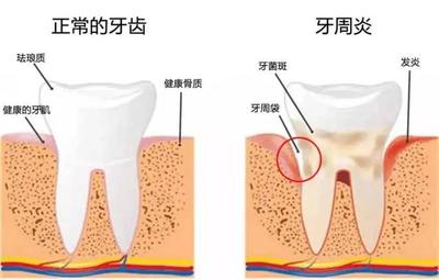 牙齿松动疼怎么治疗