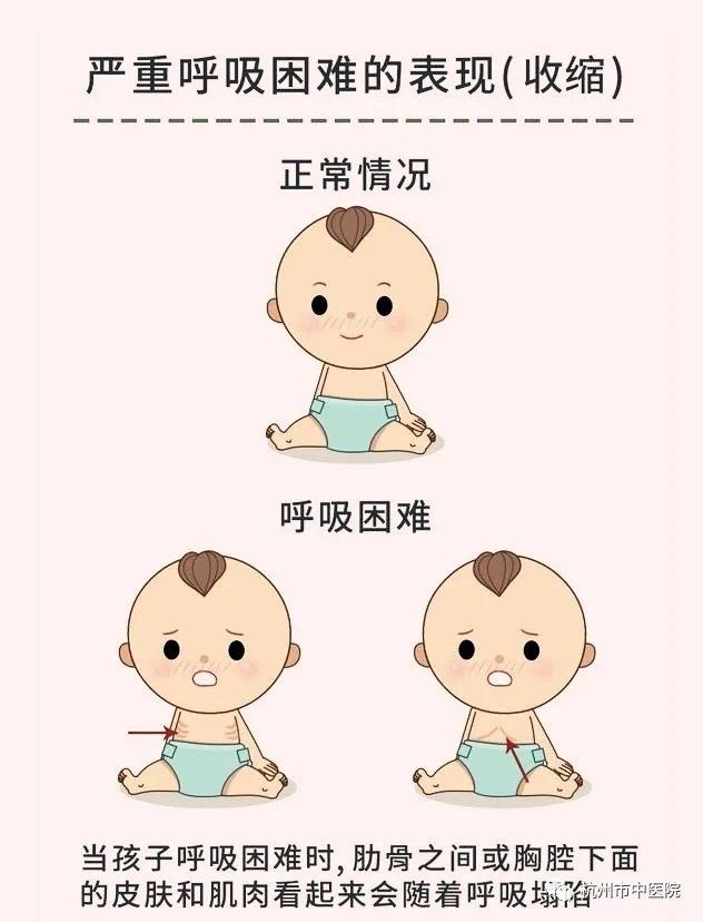 正常宝宝的肋骨图片