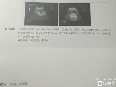 孕9周胎儿