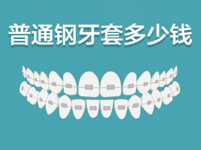 在医院带牙套好多少钱一个