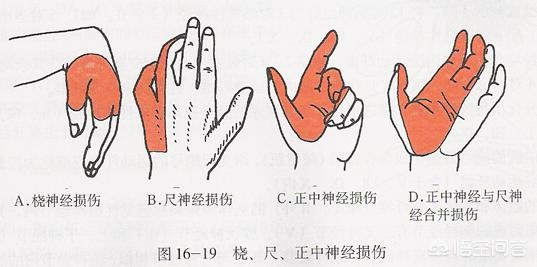手指头尖麻是怎么回事