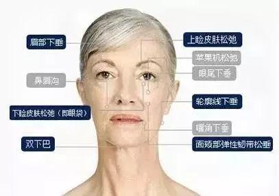 脸部提拉怎么做