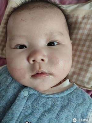 宝宝湿疹医生开了蓝润
