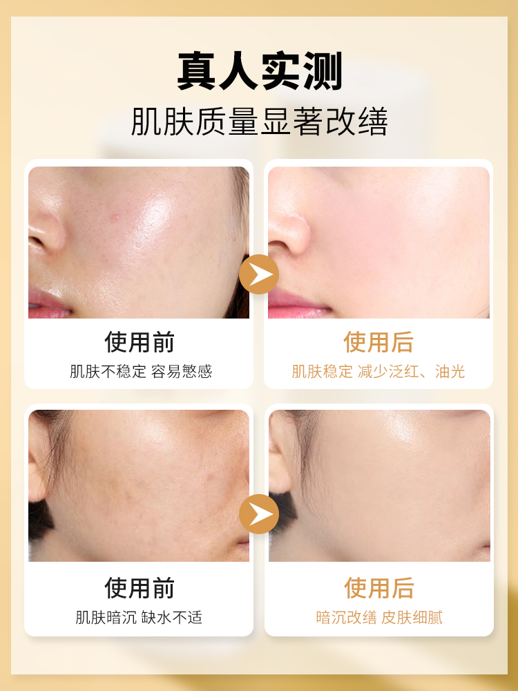 水乳中的水是爽肤水吗