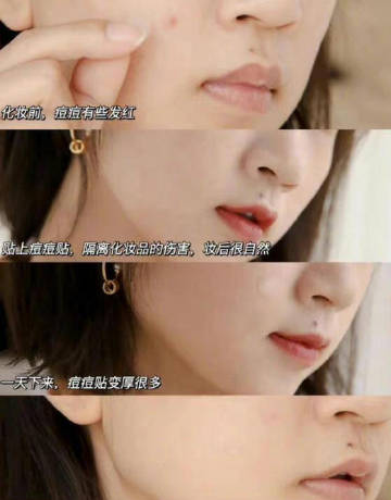 贴上痘痘贴化妆