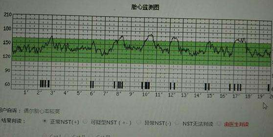 心跳没分钟多少次正常值