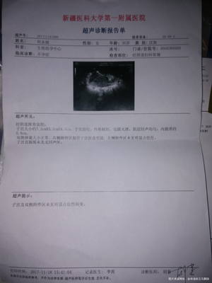 输卵管有积液是怎么回事